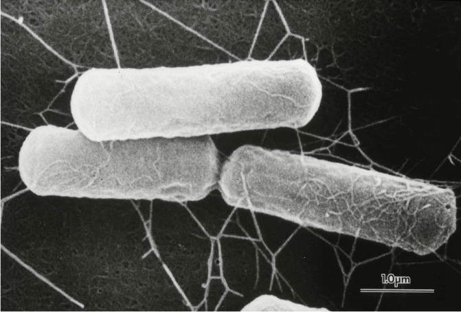 ウエルシュ菌による食中毒｜電子顕微鏡写真